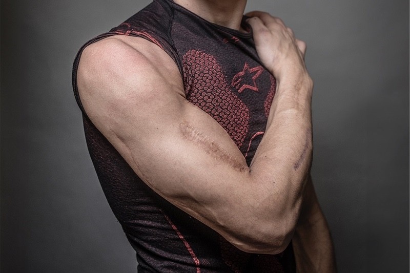 Marc Marquez blessure